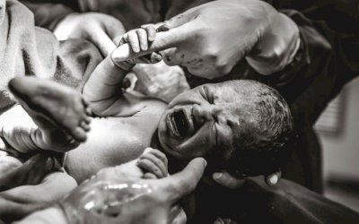 Ainda dentro da barriga da mãe, bebê segura mão de médica