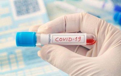 Com 474 novas mortes, Brasil registra mais vítimas da COVID-19 que a China