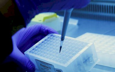 Brasil tem 15 pesquisas de vacina contra covid em andamento