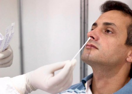 A Fiocruz acaba de finalizar o desenvolvimento de dois novos testes moleculares para o diagnóstico da Covid-19