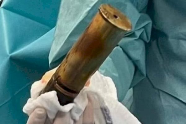 Homem faz hospital ser evacuado ao chegar no local com bomba no ânus.