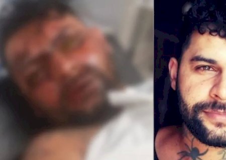 Tatuador fica cego após ex-namorada jogar soda cáustica no rosto dele em saída de academia