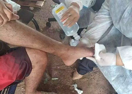 Cansado de esperar em fila de cirurgia, homem amputa dedos sozinho