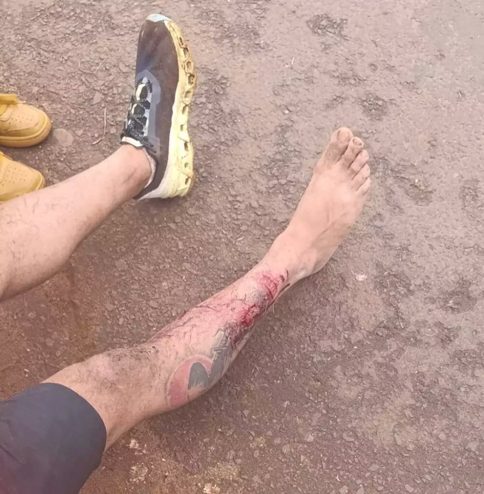 Lutador imobiliza dois pit bulls para escapar de ataque na rua