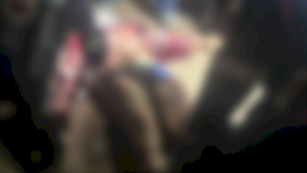 Entregador tem orelha dilacerada e artéria rompida após ataque de pit bulls