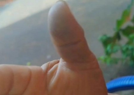 Ivinhema - Motociclista foge após provocar acidente com idoso de 74 anos no bairro Vitória